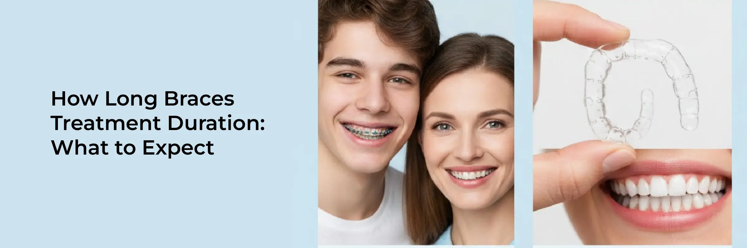 How Long Braces Treatment Usually Takes