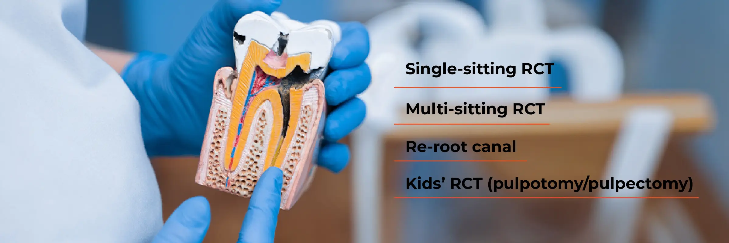 Types of Root Canal Treatments