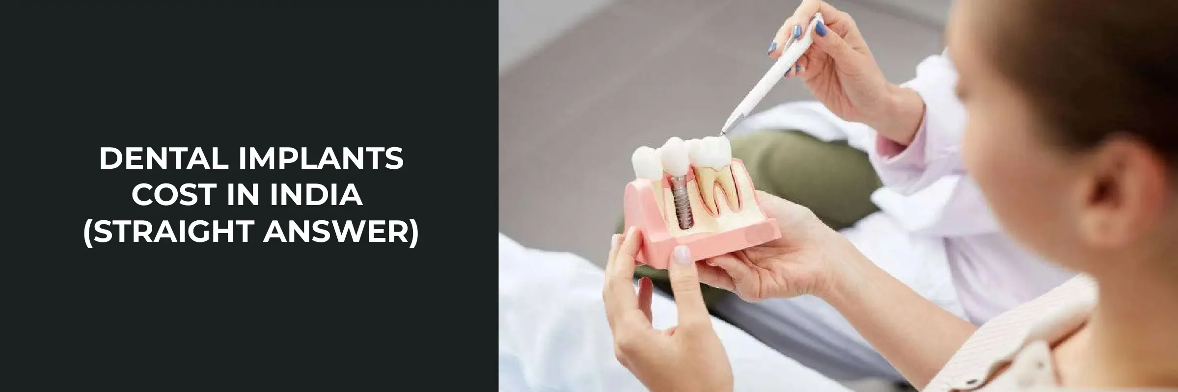 Dental Implants Cost in India