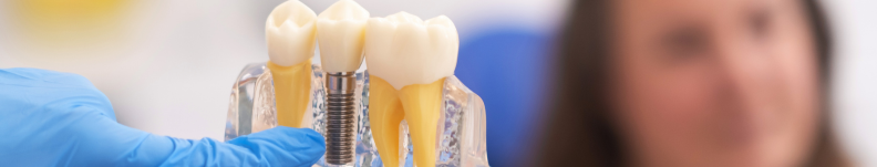 Dental Implant Cost in Gurgaon