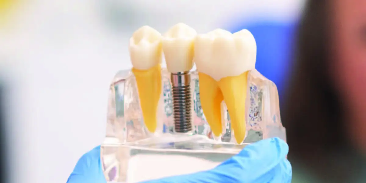 Invisalign Initial Consultation