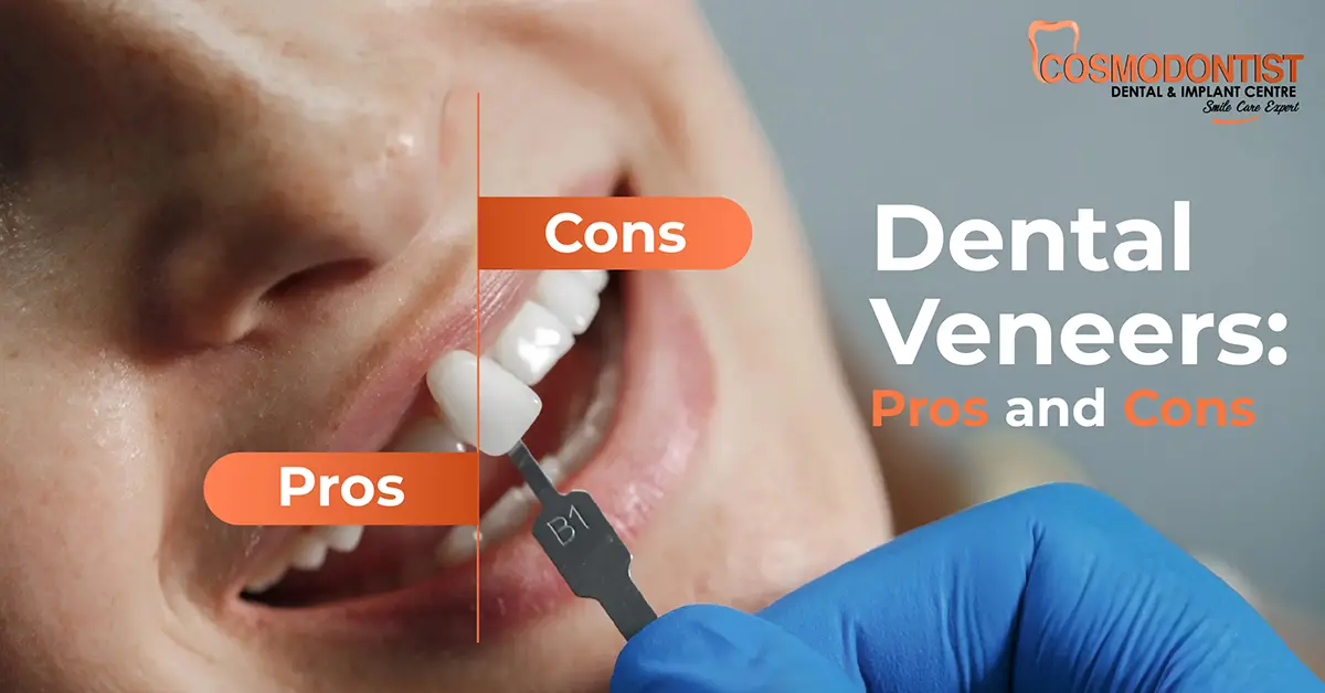 Dental Veneers: Pros And Cons