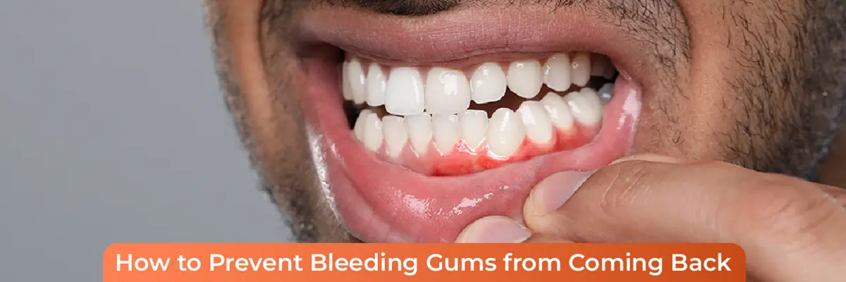 Daily Oral Care Tips for Healthy Teeth