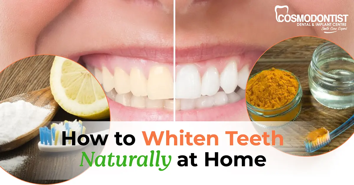 How to Whiten Teeth Naturally at Home