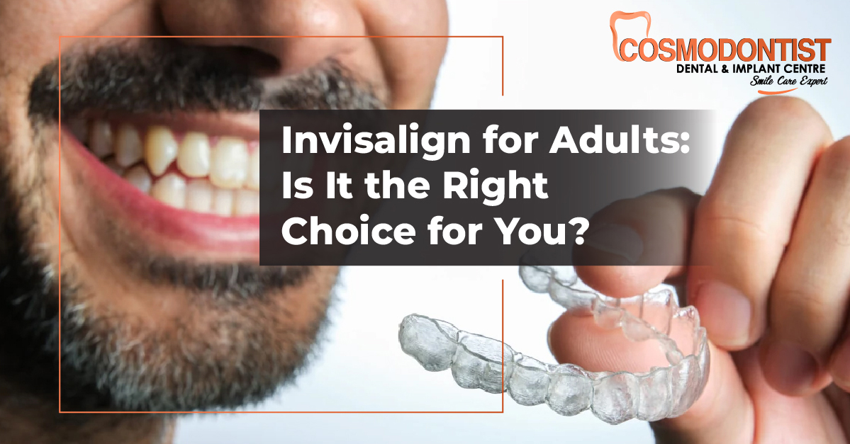 Invisalign Treatment Process