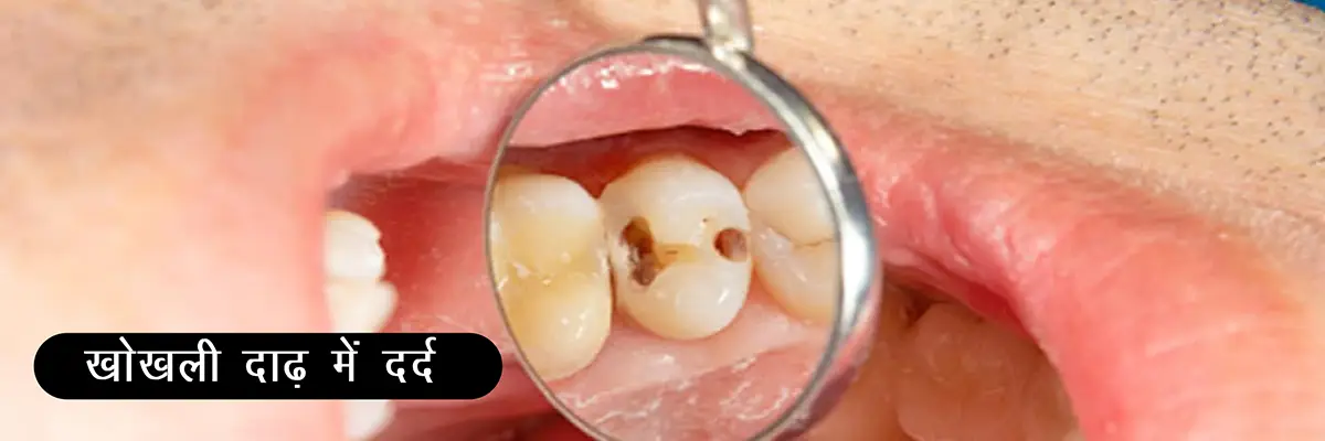 (Gum Disease