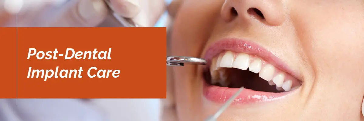 Invisalign Initial Consultation