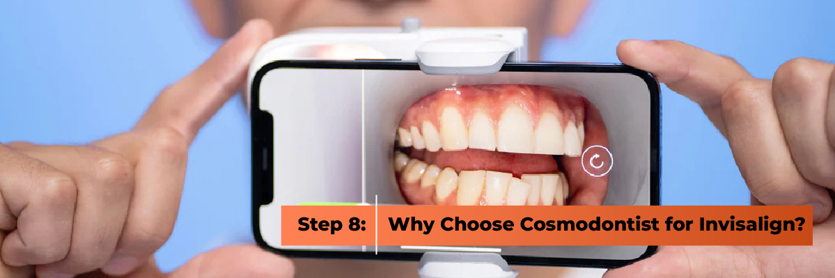 Retainers and Post Treatment Care