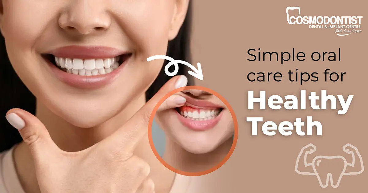 Daily Oral Care Tips for Healthy Teeth