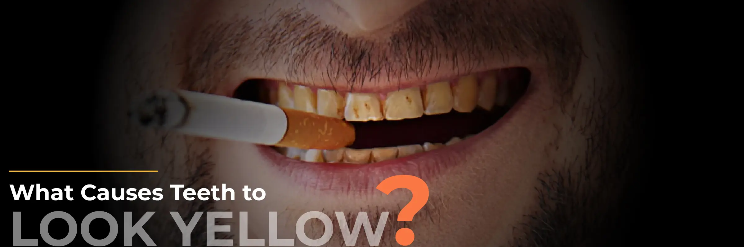 causes of yellow teeth and stains