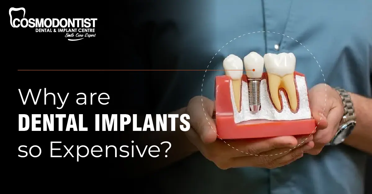 Why Are Dental Implants So Expensive?