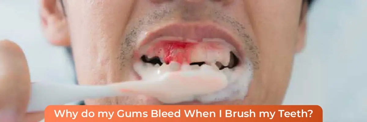 Daily Oral Care Tips for Healthy Teeth