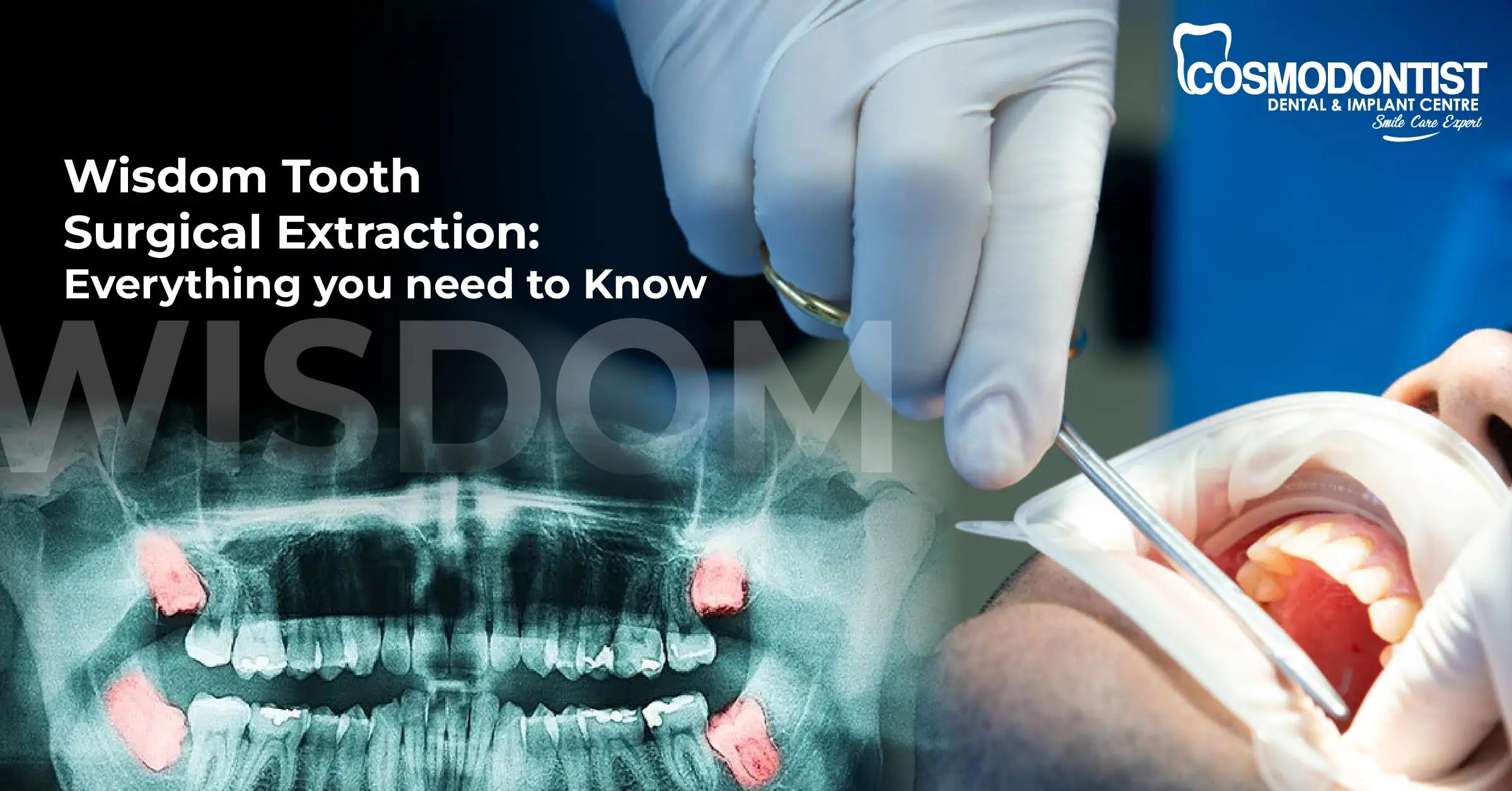 Tooth Pain Causes & Home Remedies