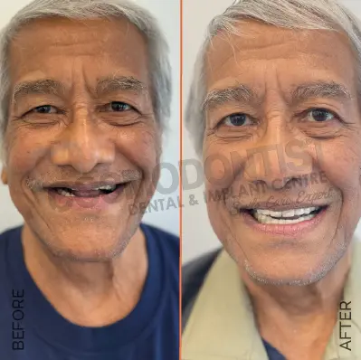before after