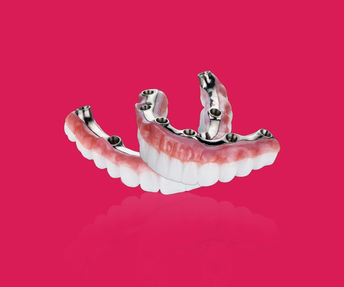 All-on-X Dental Implants